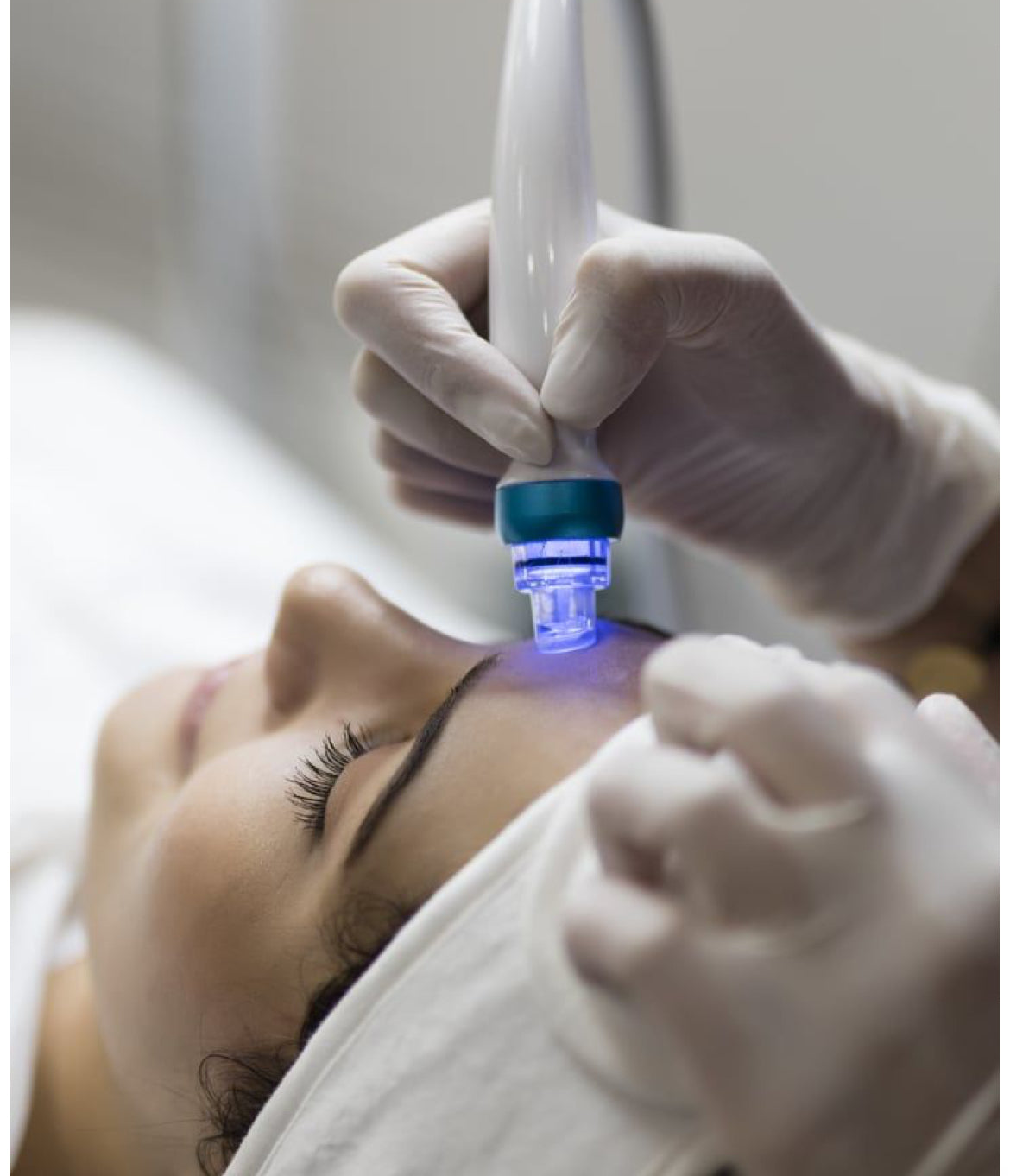 Seniya’s Microdermabrasion