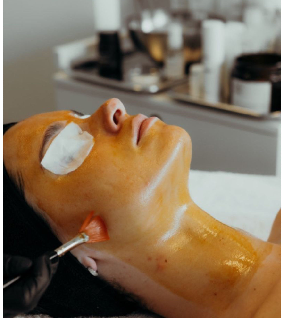 Seniya’s Chemical Peel