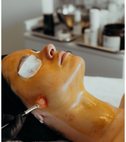 Seniya’s Chemical Peel